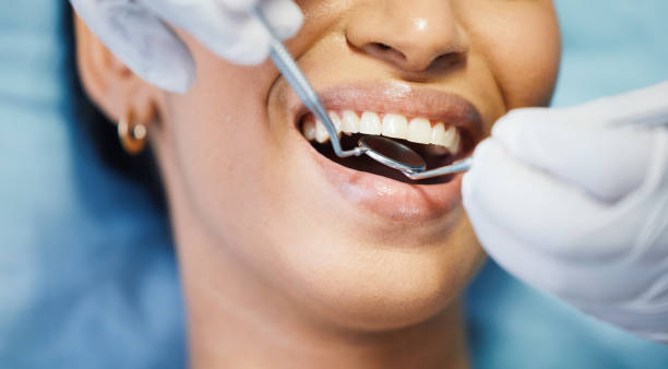 Best Emergency Treatment for Toothache in Buckeystown, MD